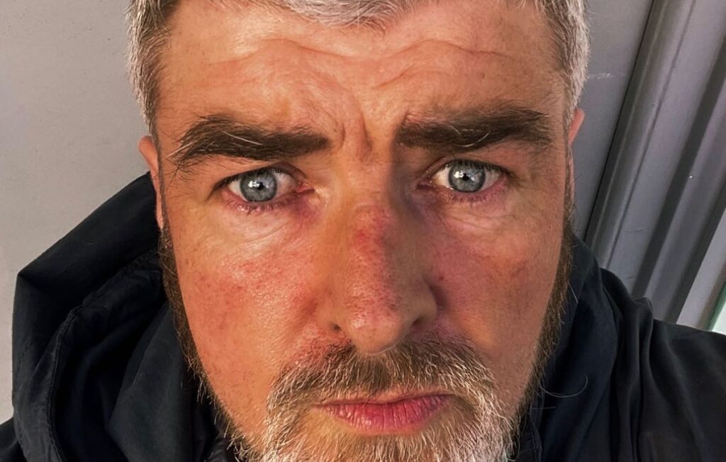 Noel's brother and Liam Gallagher was accused of rape