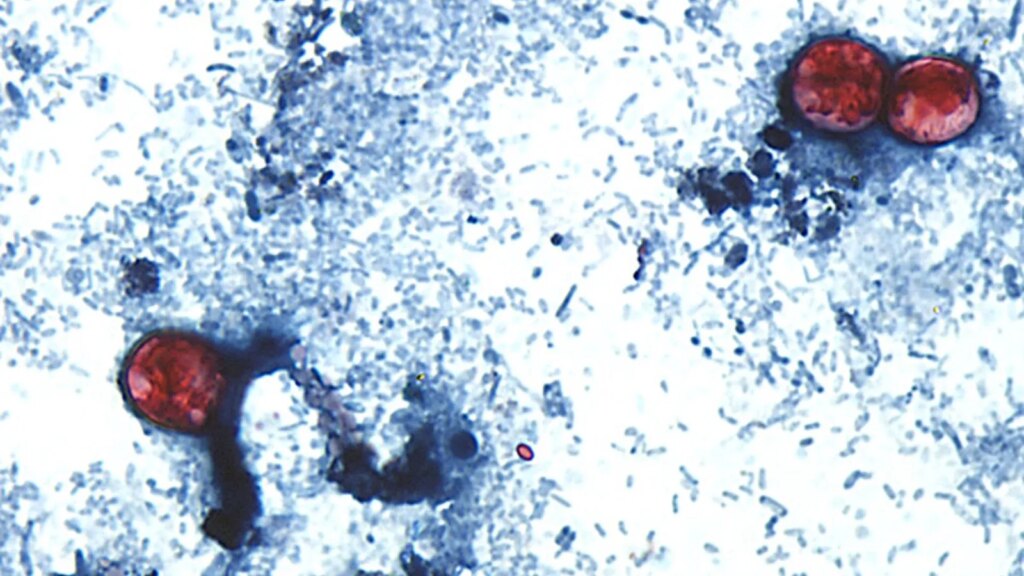 Cyclospora Adds Gross Layer to an Already Tough Summer